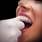 Orthodontics / Braces